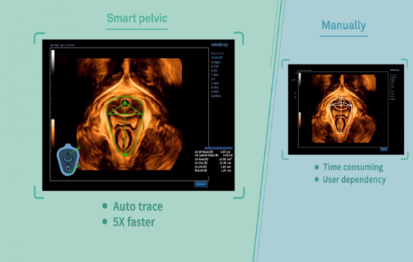 Smart Pelvic